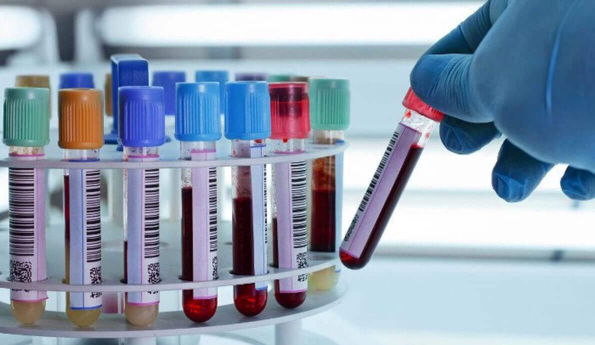 Natural remedies for quick bruising